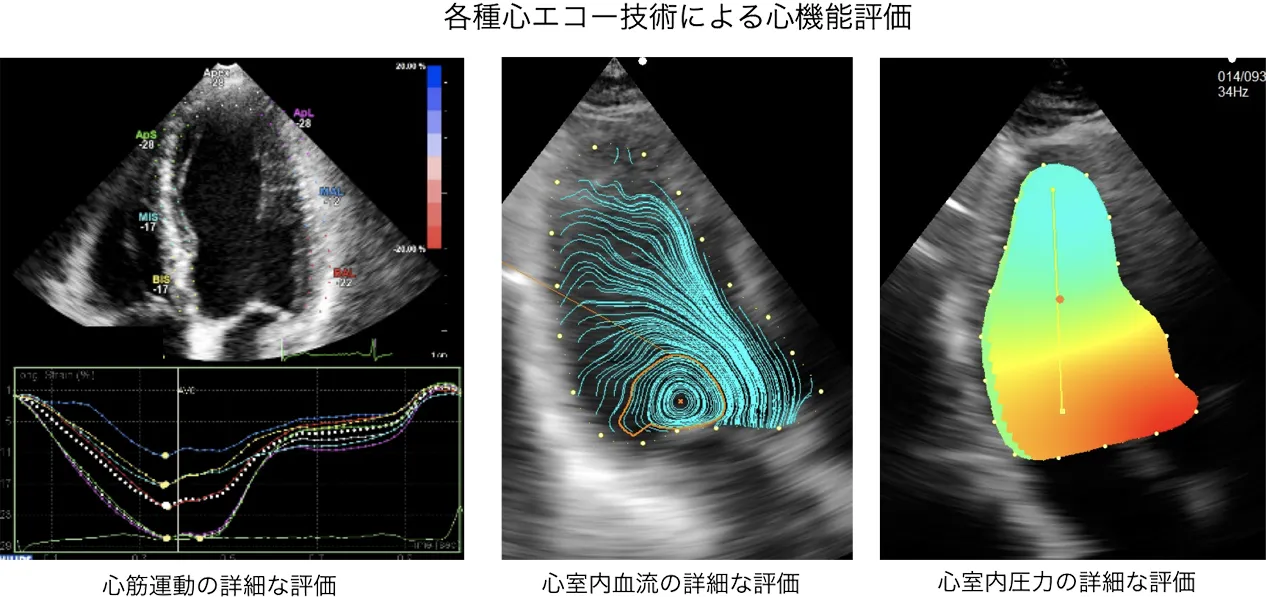 心エコー新技術による心機能評価法